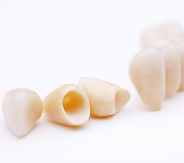 Lutz Dental Crowns and Dental Bridges