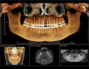 3D Image