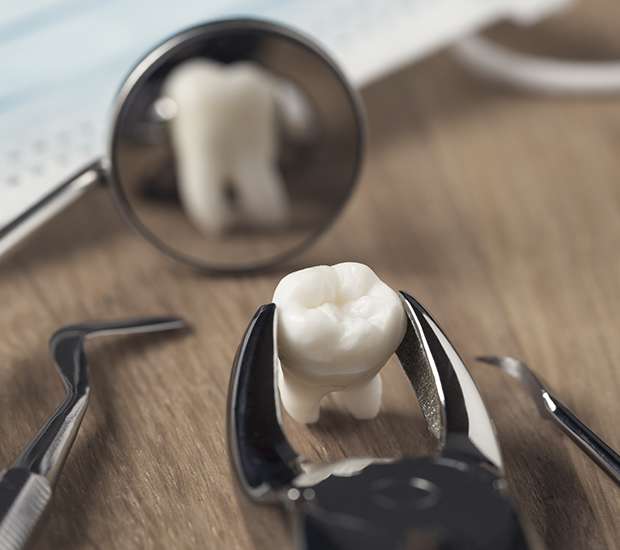 Lutz When Is a Tooth Extraction Necessary